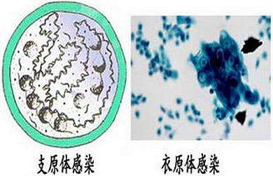 借卵做试管第四天的卵泡正常值是多少