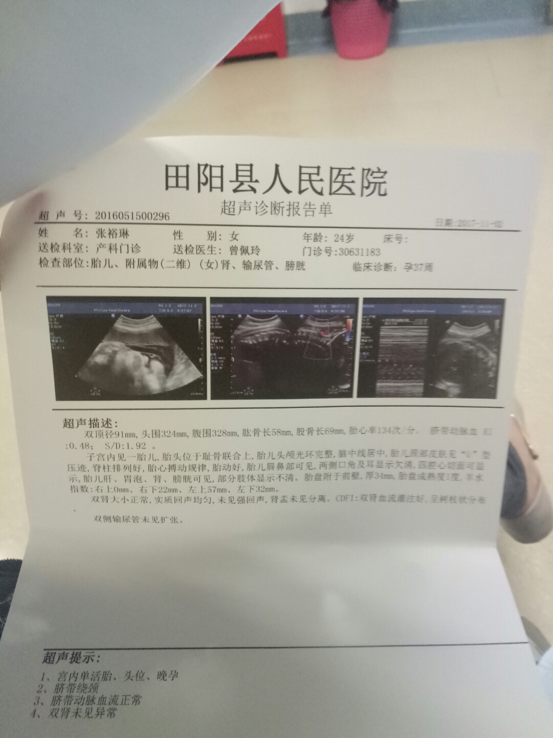 网上说乌克兰供卵试管混血宝宝需要18万是真的吗