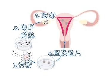 上海可以做借卵试管婴儿吗