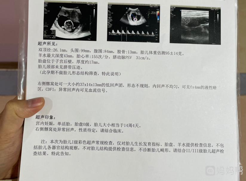 上海唐都医院做试管婴儿成功率多少